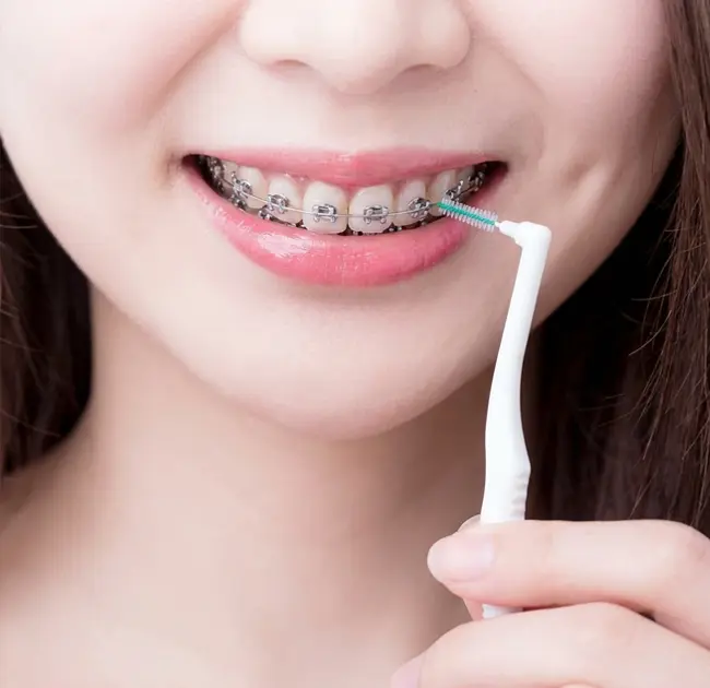 Interdental Brushes များသည် ခံတွင်းသန့်စင်မှုဆိုင်ရာ အတွေ့အကြုံအသစ်ကို ဖန်တီးပါ။